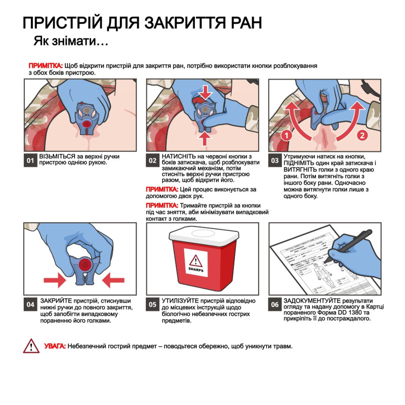 Пристрій для закриття ран iTClamp